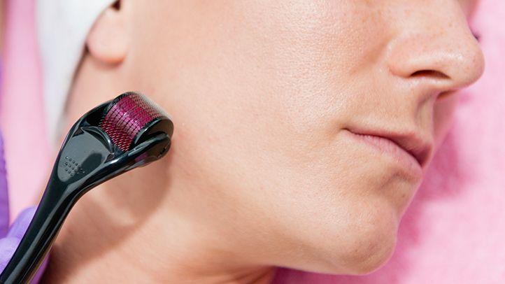 Derma Roller Anti Ageing And Facial Scrubs - Polishes Scar Removal Hair Regrowth